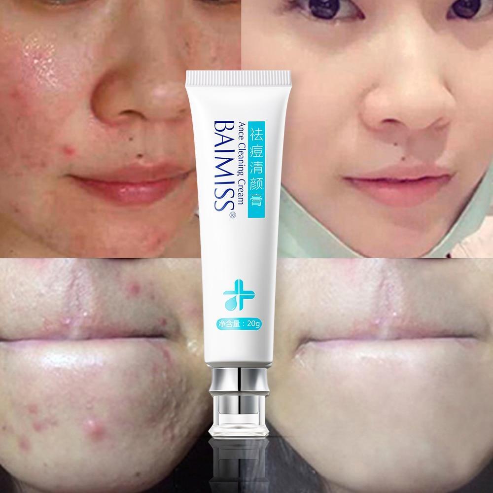 Natural Herbal Scar Gel for Skin Serum BAIMISS Official Store