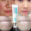 Natural Herbal Scar Gel for Skin Serum BAIMISS Official Store