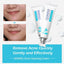 Natural Herbal Scar Gel for Skin Serum BAIMISS Official Store