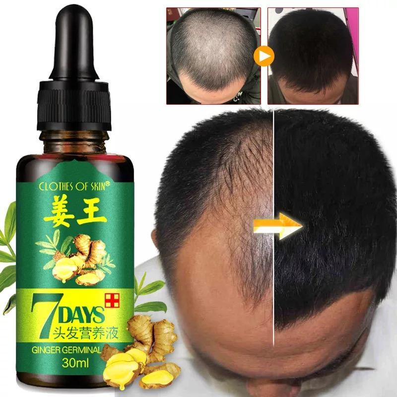 Natural Repair Hair Growth Liquid Hair Loss Products OSHIONER Official Store