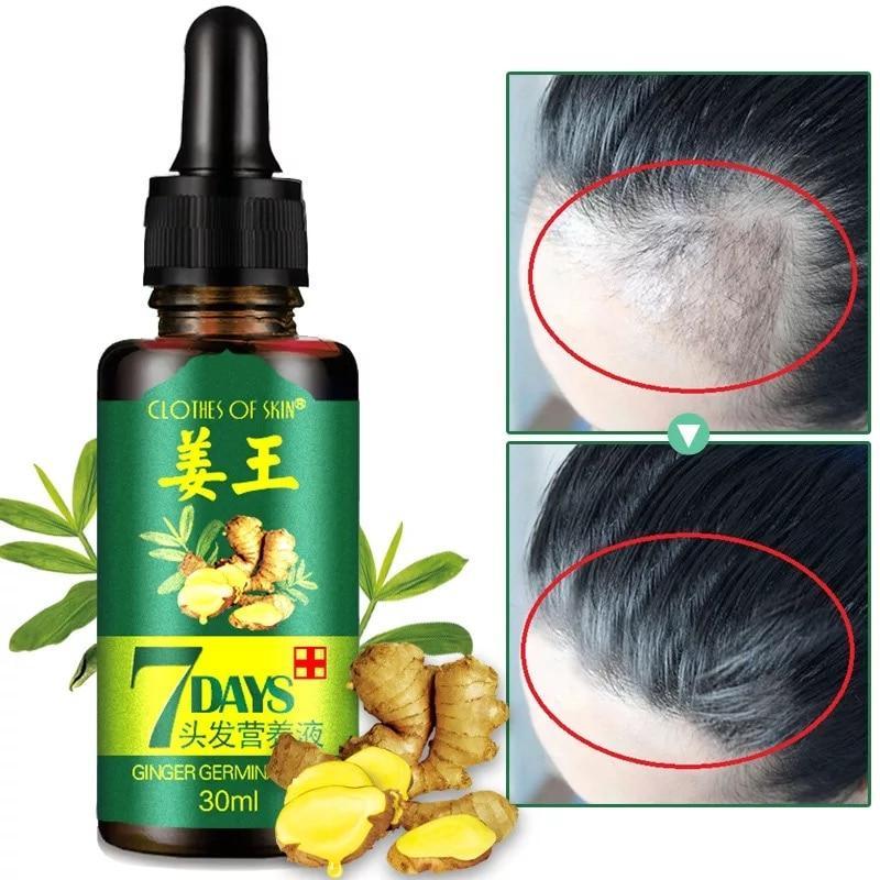 Natural Repair Hair Growth Liquid Hair Loss Products OSHIONER Official Store
