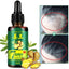 Natural Repair Hair Growth Liquid Hair Loss Products OSHIONER Official Store