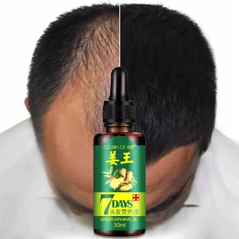 Natural Repair Hair Growth Liquid Hair Loss Products OSHIONER Official Store