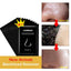Nose Acne Treatment Peeling Mask Treatments & Masks LANBENA