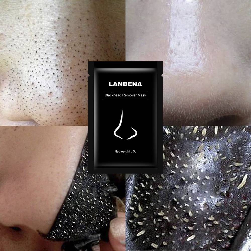 Nose Acne Treatment Peeling Mask Treatments & Masks LANBENA