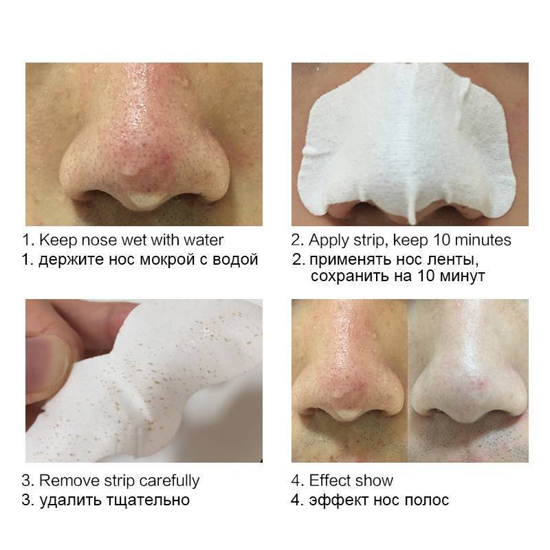 Nose Mask Shill for Acne Black Head Treatments & Masks SACE LADY Official Store