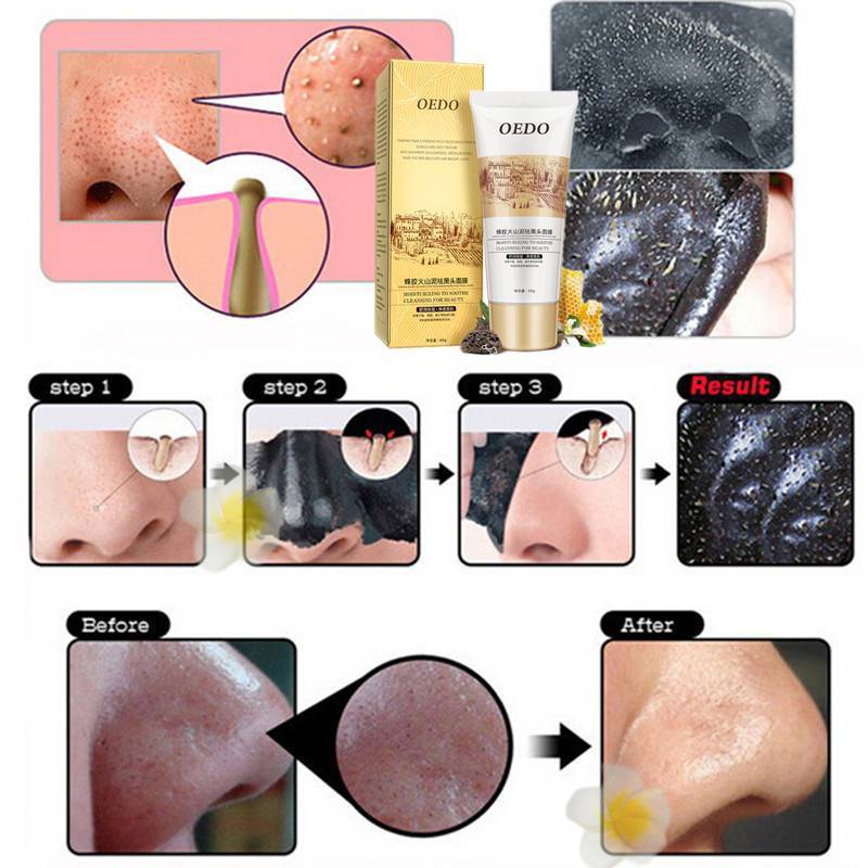 Nose Peeling Skin Care Mask Treatments & Masks OEDO Official Store