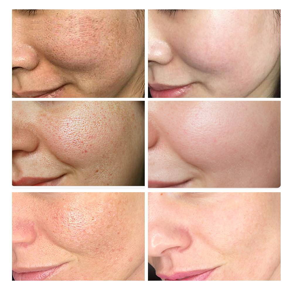 Nourishing Repairing Whitening Cream Serum BREYLEE Official Store