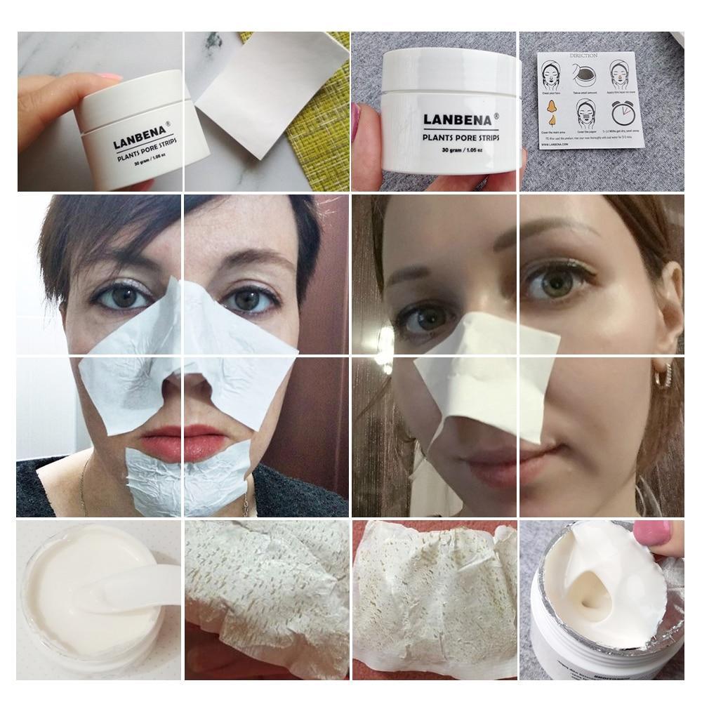 Oil-Control Aloe vera Nose Mask Treatments & Masks Mozilend Apricot beautiful Store