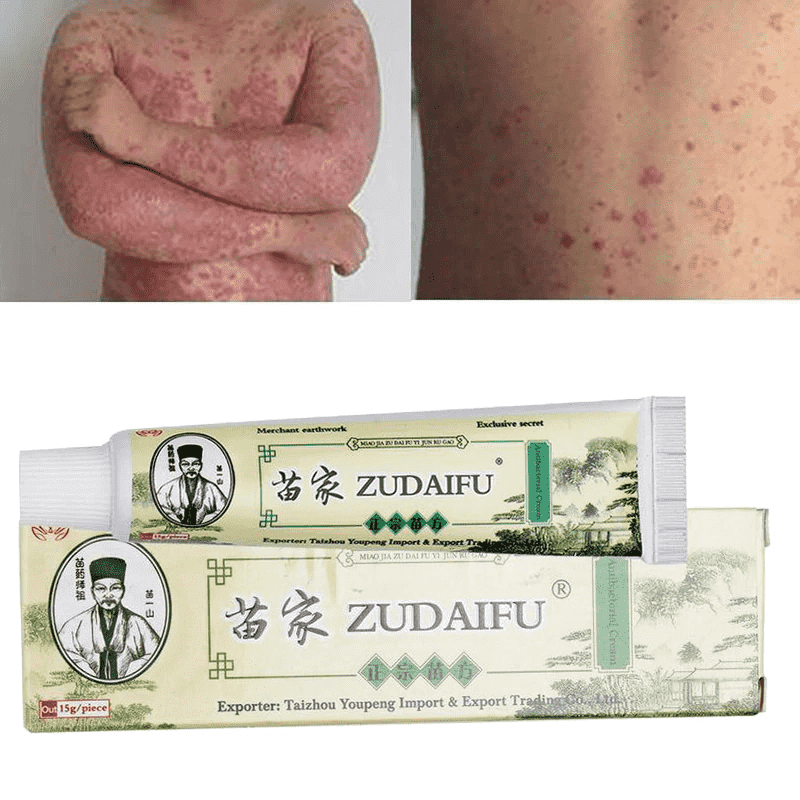 Skin Psoriasis Cream Dermatitis Eczema Body Self Tanner Ointment Body Self Tanners & Bronzers UOYOTT Healthy Store
