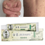 Skin Psoriasis Cream Dermatitis Eczema Body Self Tanner Ointment Body Self Tanners & Bronzers UOYOTT Healthy Store