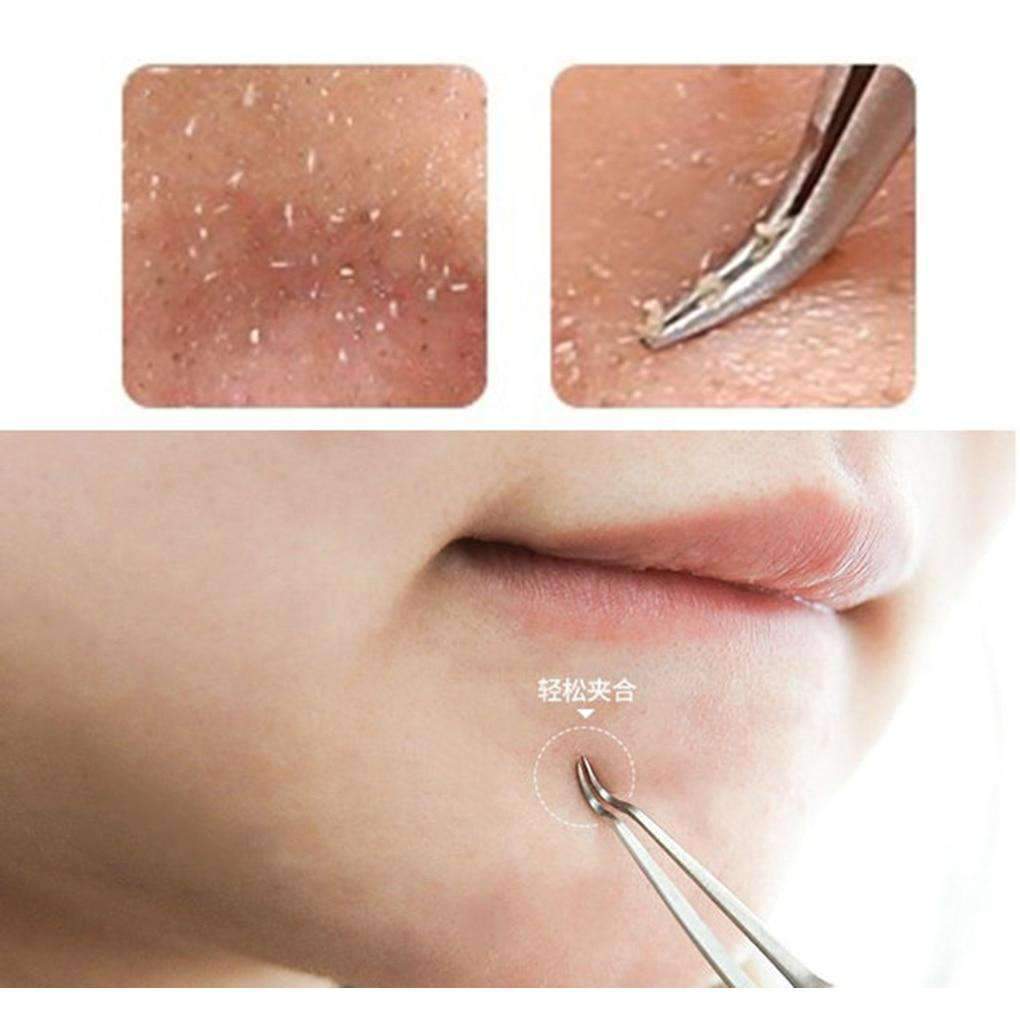 Stainless Steel Bend Curved Blackhead Acne Clip Tweezer Nose & Ear Trimmer Run Beauty house