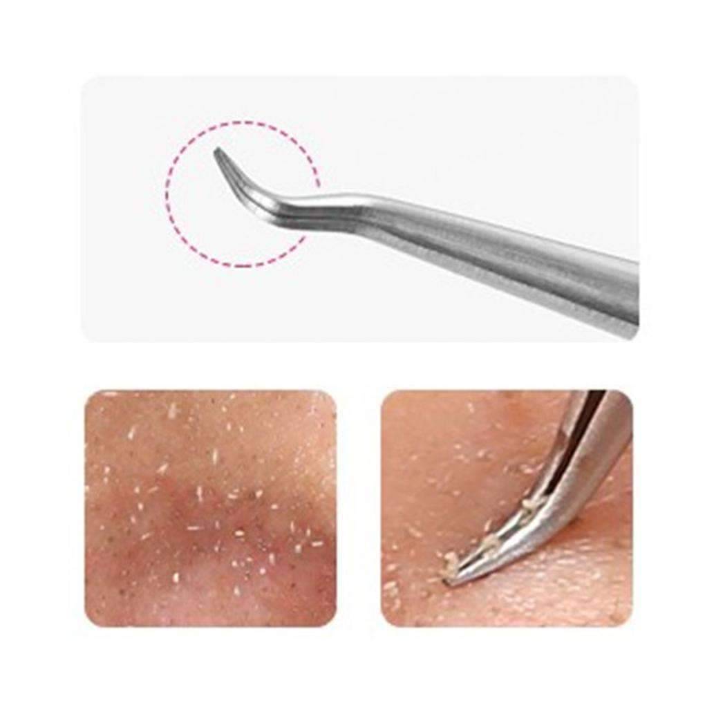 Stainless Steel Bend Curved Blackhead Acne Clip Tweezer Nose & Ear Trimmer Run Beauty house