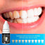 Teeth Whitener Essence Cleaning Serum Oral Hygiene Product Teeth Whitening BREYLEE Official Store Default Title