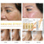 Vitamin C Ampoule Serum Serum LANBENA Official Store