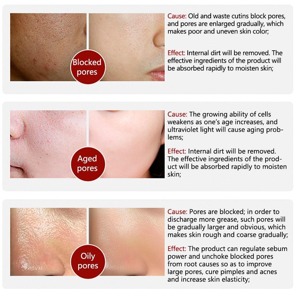 Vitamin C Shrink Pores Blackhead Remover Serum Goodlan Store