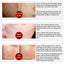 Vitamin C Shrink Pores Blackhead Remover Serum Goodlan Store