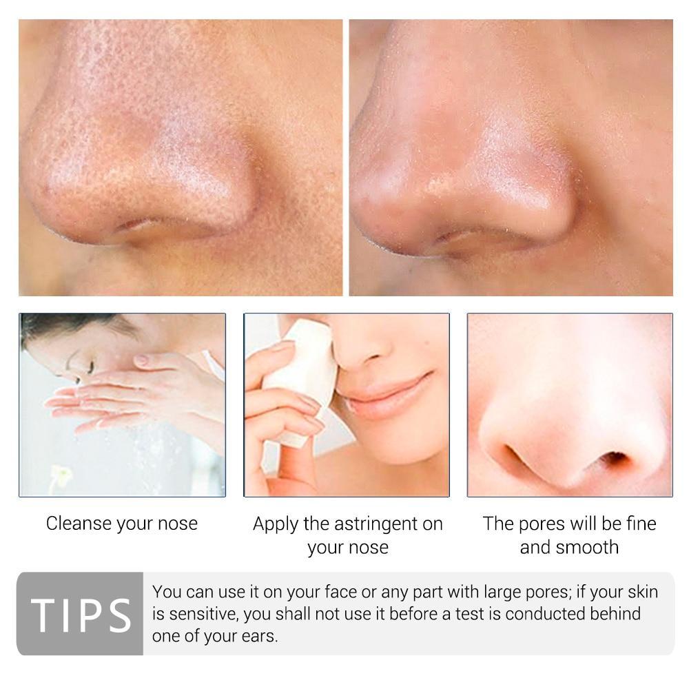 Vitamin C Shrink Pores Blackhead Remover Serum Goodlan Store