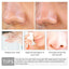 Vitamin C Shrink Pores Blackhead Remover Serum Goodlan Store
