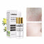 Vitamin C Shrink Pores Blackhead Remover Serum Goodlan Store