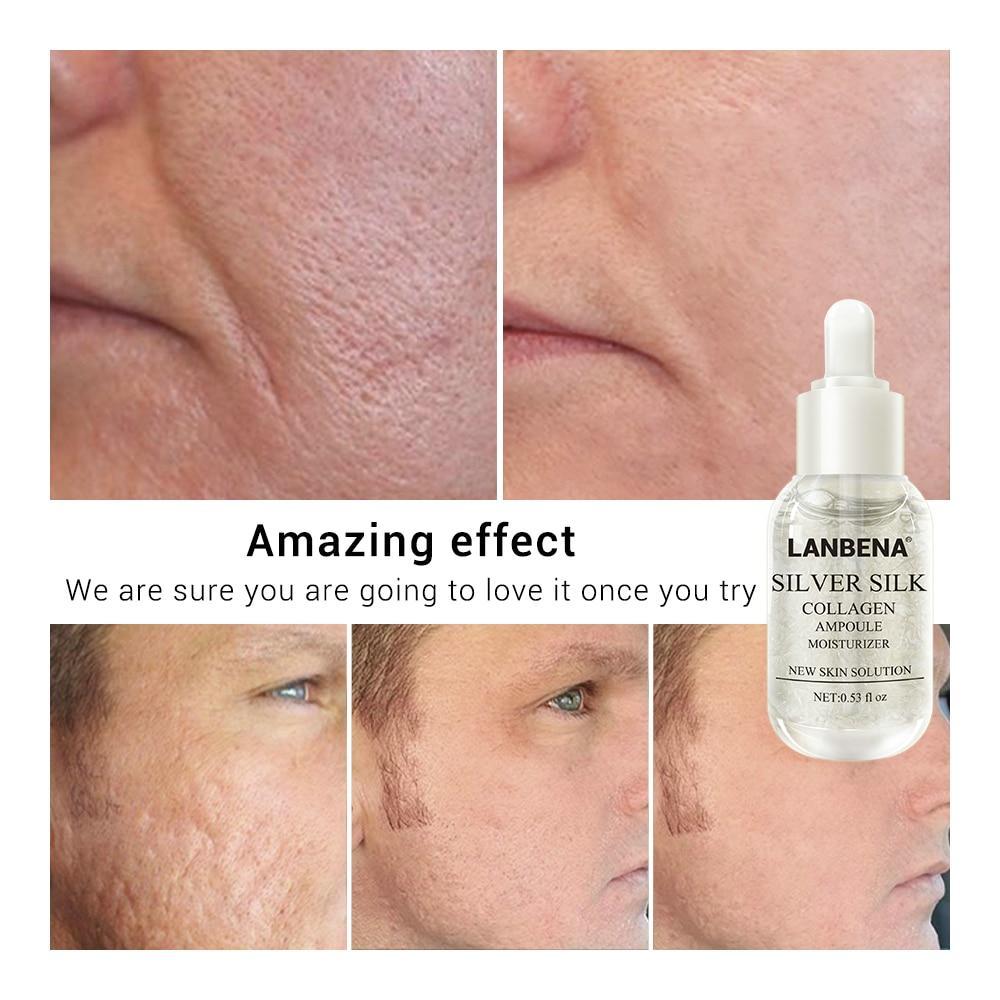 Whitening Firming Skin Care Mask Serum LANBENA Official Store