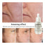 Whitening Firming Skin Care Mask Serum LANBENA Official Store