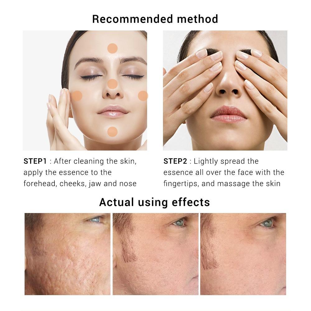 Whitening Firming Skin Care Mask Serum LANBENA Official Store