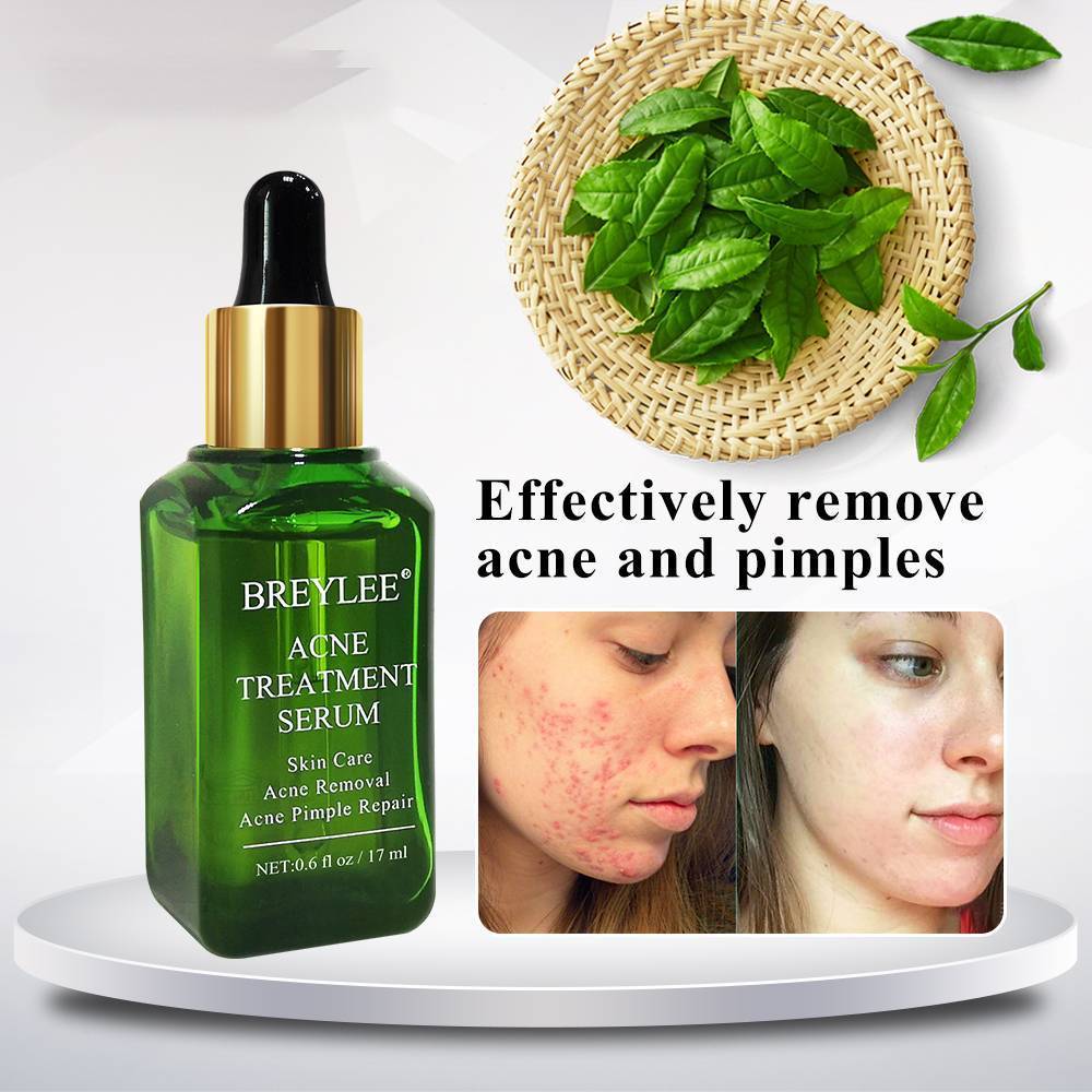 Whitening Repair Pimple Remover Cream Serum BREYLEE Official Store