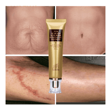 Acne Scar Removal Cream Skin Repair Whitening Facial Self Tanners Cream Facial Self Tanners & Bronzers LANBENA Official Store