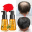 Anti Hair Loss Treatment Hair Growth Essence Hair & Scalp Treatments RtopR Official Store 