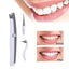 Electric Ultrasonic Tooth Strain Remover Oral Hygiene Product Teeth Whitening guomin yang's store 