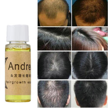 Fast Anti-Hair Loss Liquid Hair Loss Products Ageless Beauty Care 