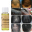 Fast Anti-Hair Loss Liquid Hair Loss Products Ageless Beauty Care 