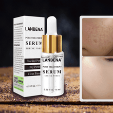Hyaluronic Acid Serum Anti-Aging Skin Care Acne Treatment Serum LANBENA Official Store