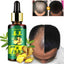 Natural Anti Hair Loss Liquid Hair Growth Essence Hair & Scalp Treatments Cosmetic Diary 