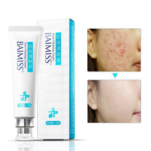 Natural Herbal Scar Gel for Skin Serum BAIMISS Official Store 