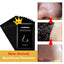 Nose Acne Treatment Peeling Mask