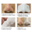 Nose Mask Shill for Acne Black Head Treatments & Masks SACE LADY Official Store 